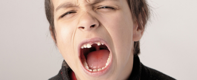 Essential Dental - Dental Trauma and First Aid