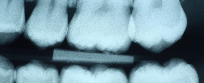 Essential Dental - X-rays provide a comprehensive assessment of your teeth