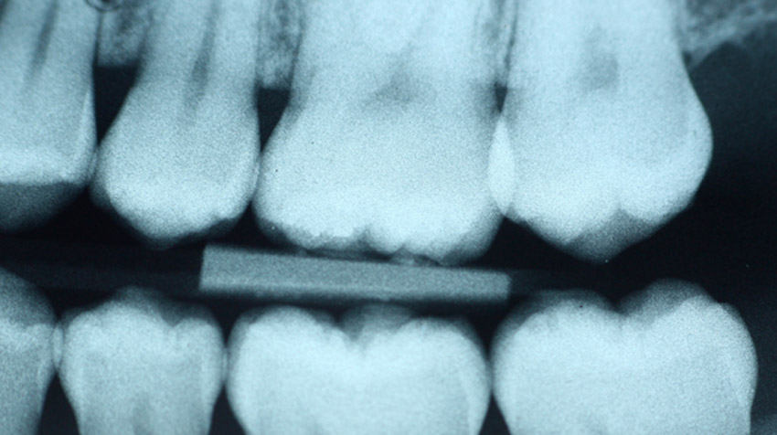 Essential Dental - X-rays provide a comprehensive assessment of your teeth
