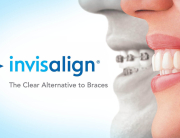 Essential Dental - Invisalign The Facts