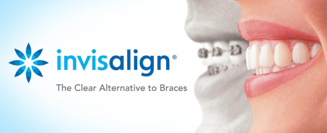 Essential Dental - Invisalign The Facts